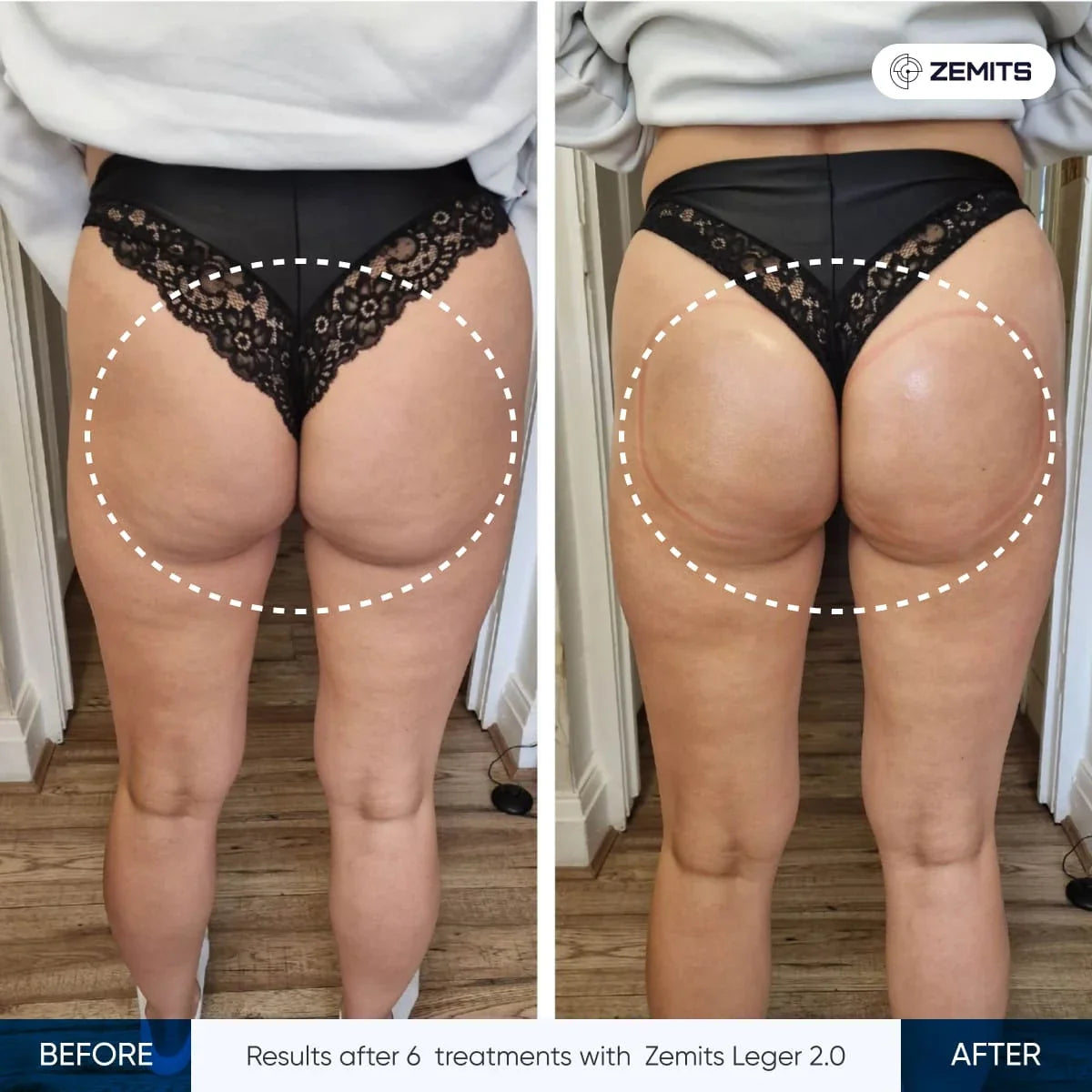 Before After Slide 5