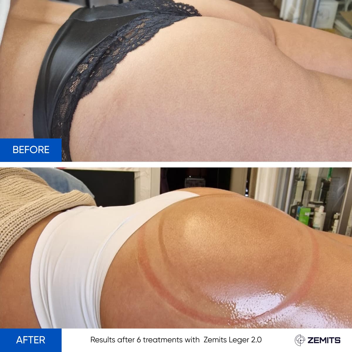Before After Slide 7