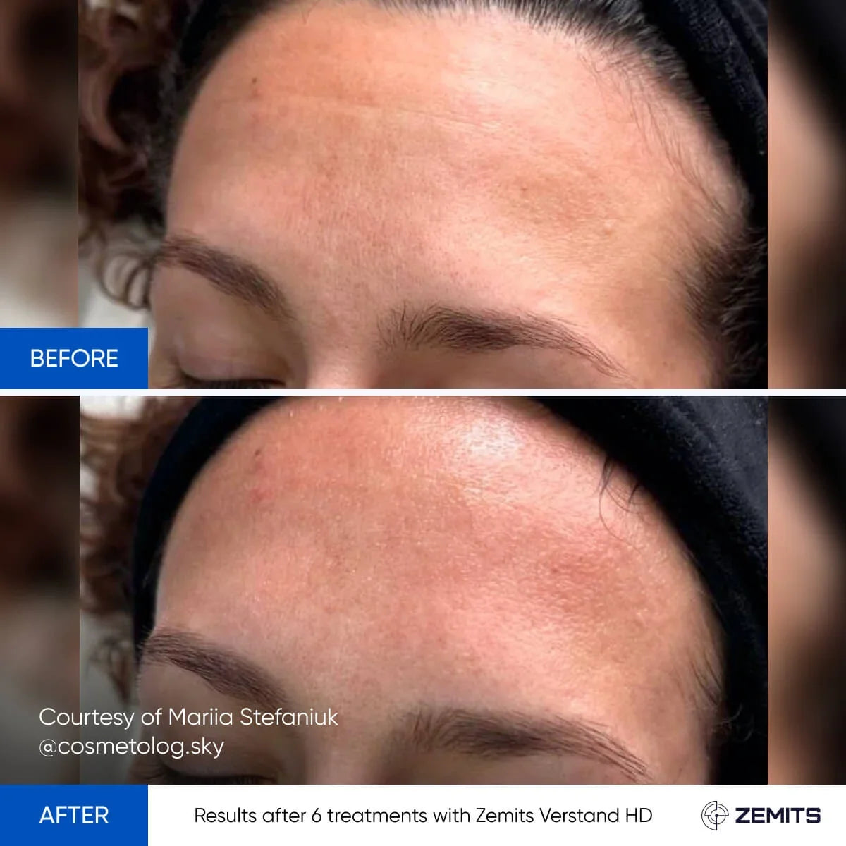 Before After Slide 5