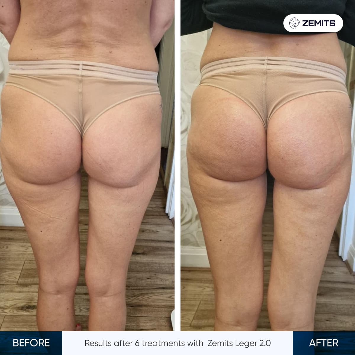 Before After Slide 6