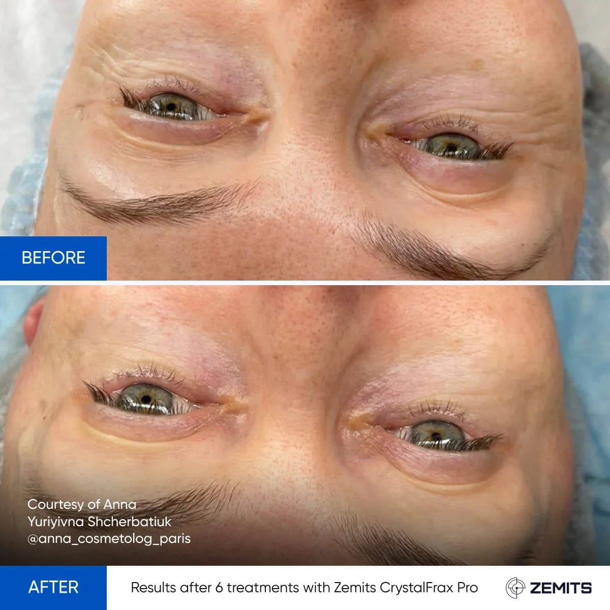Before After Slide 5