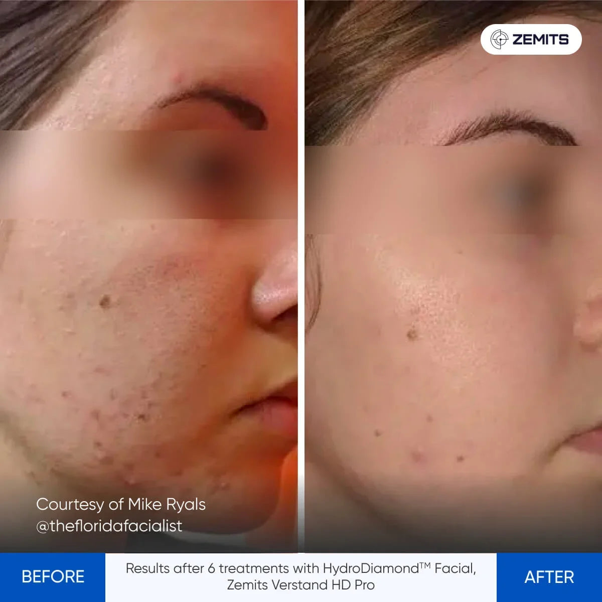 Before After Slide 3