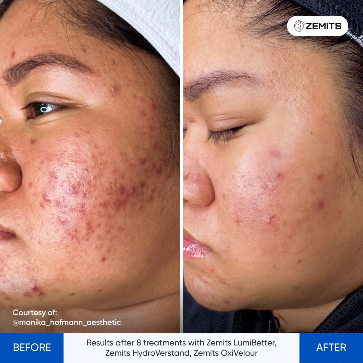 Before After Slide 1