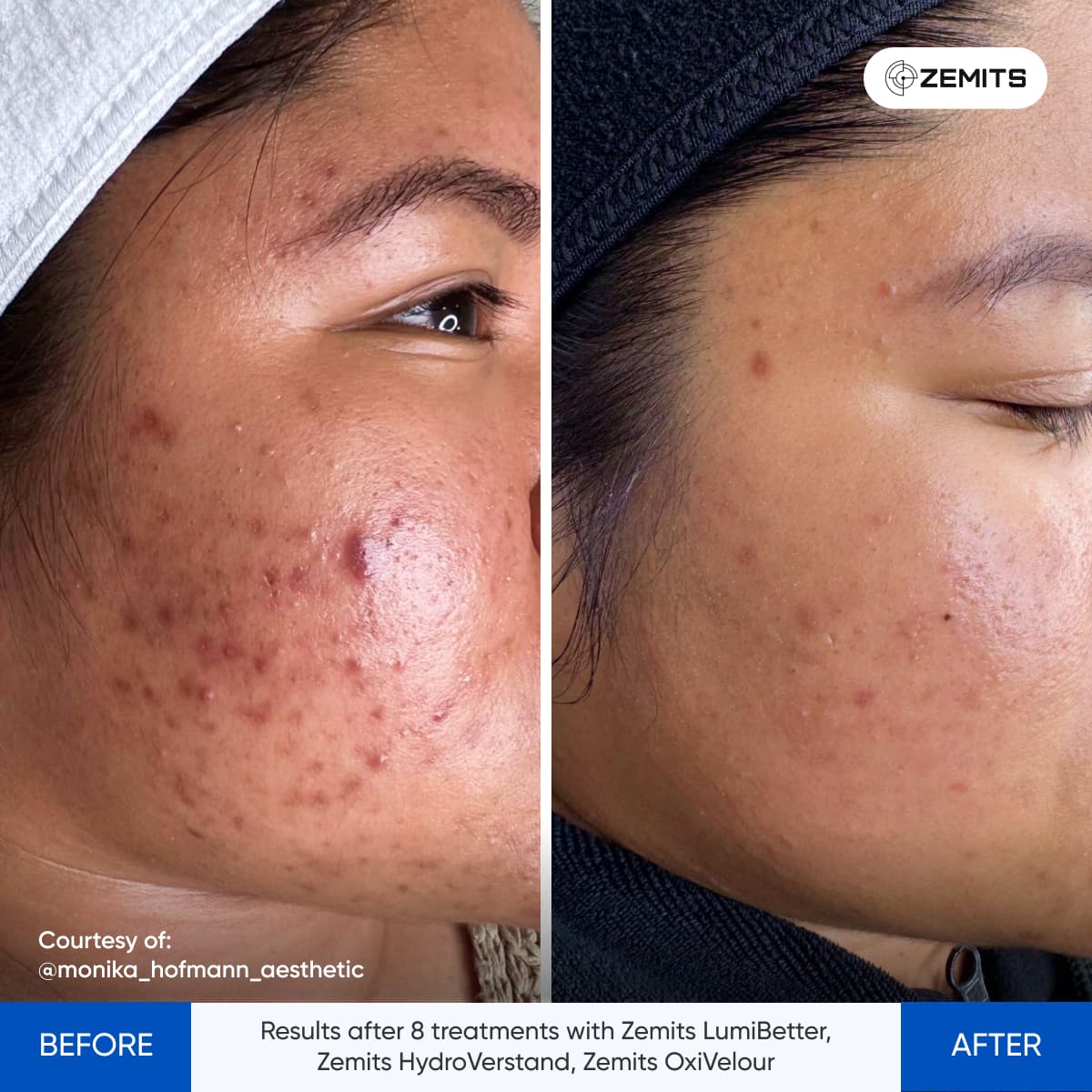 Before After Slide 1