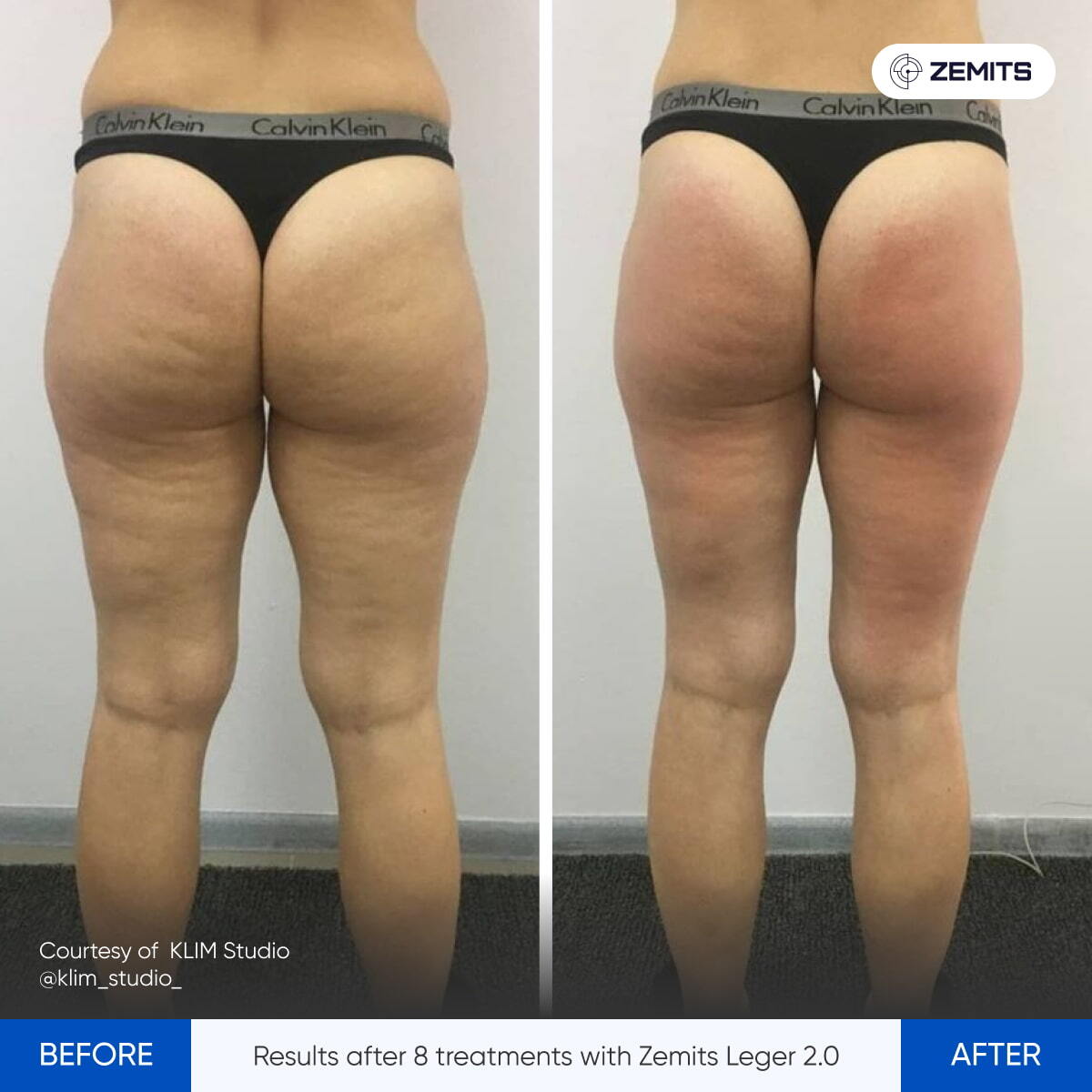 Before After Slide 8