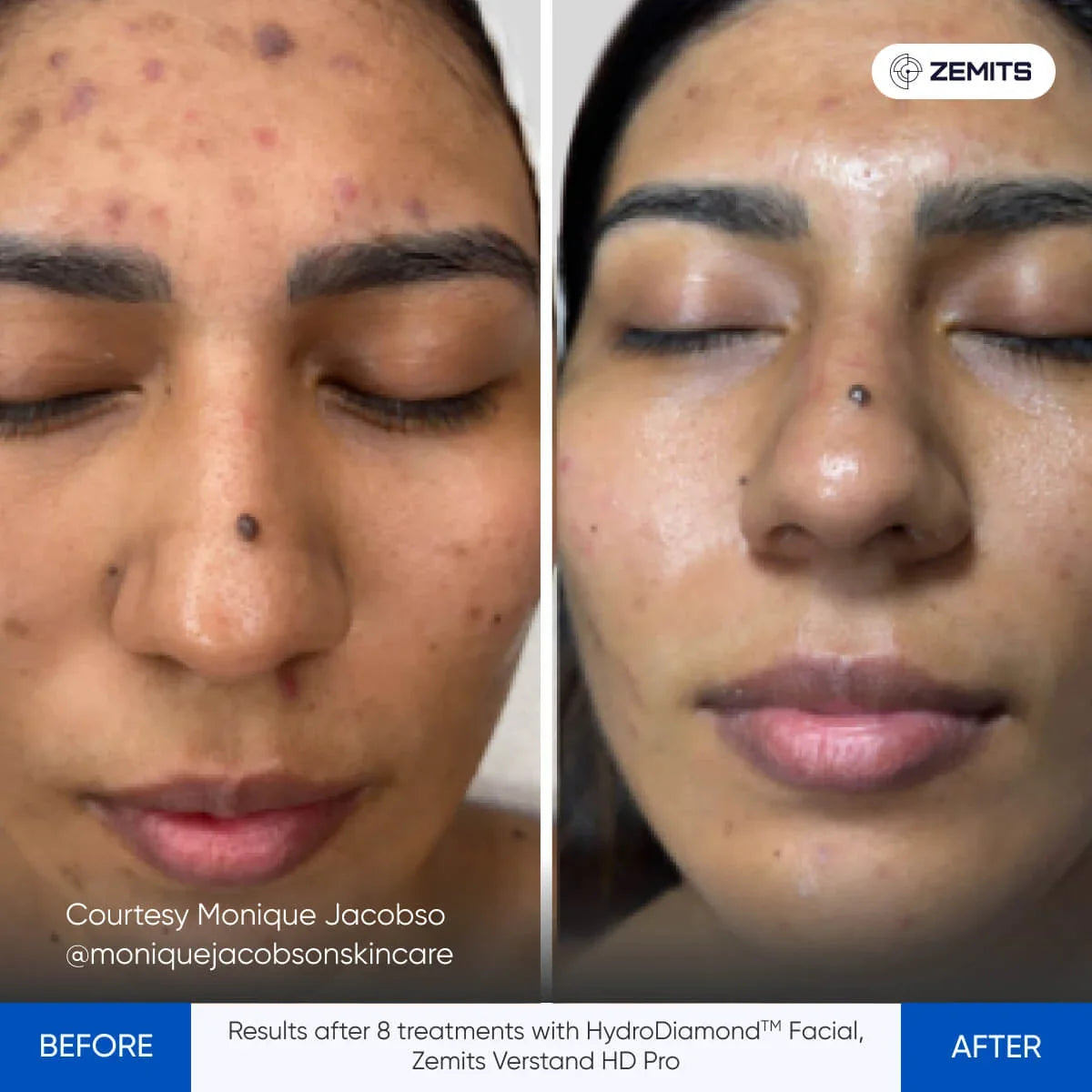 Before After Slide 2
