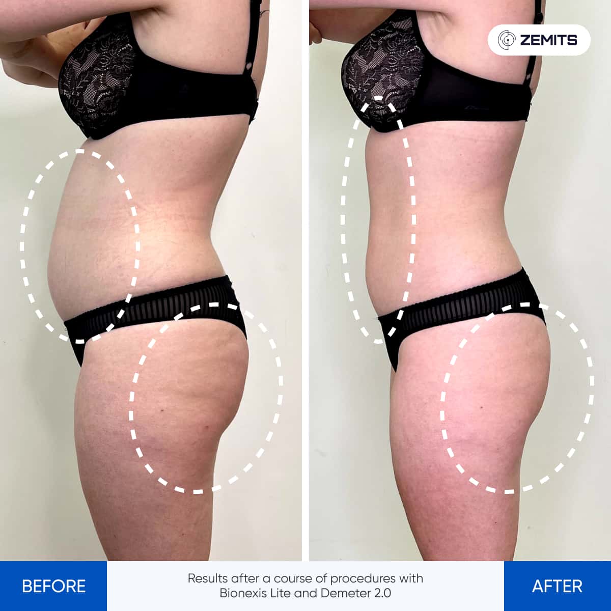 Before After Slide 3