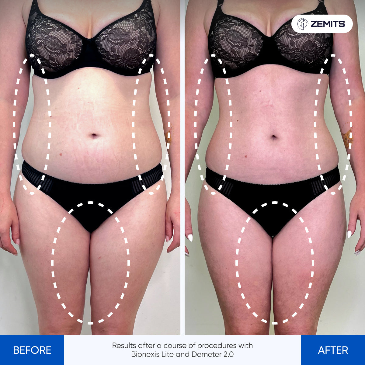 Before After Slide 1