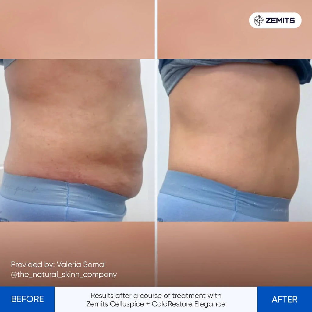 Zemits CelluSpice Pro