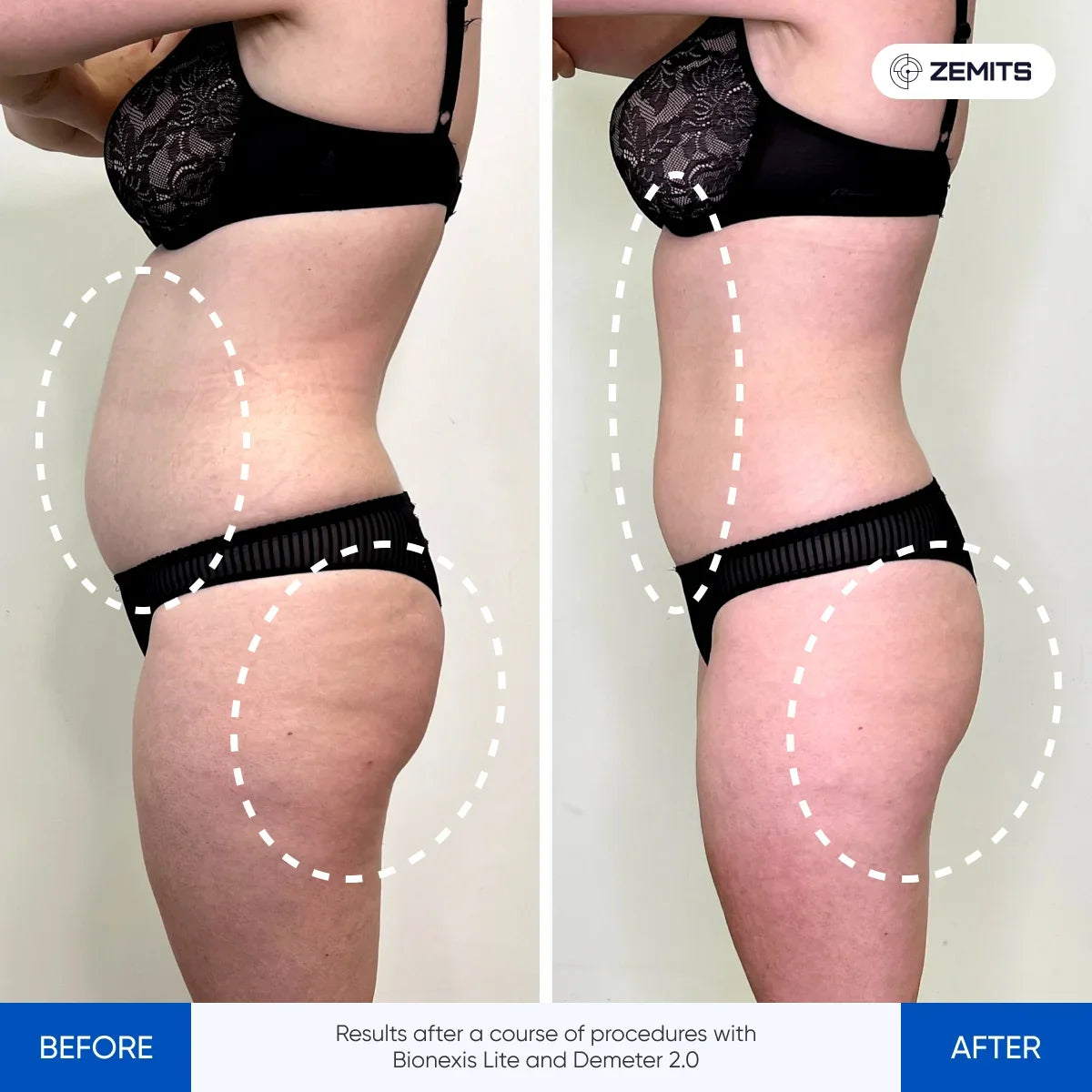 Before After Slide 2