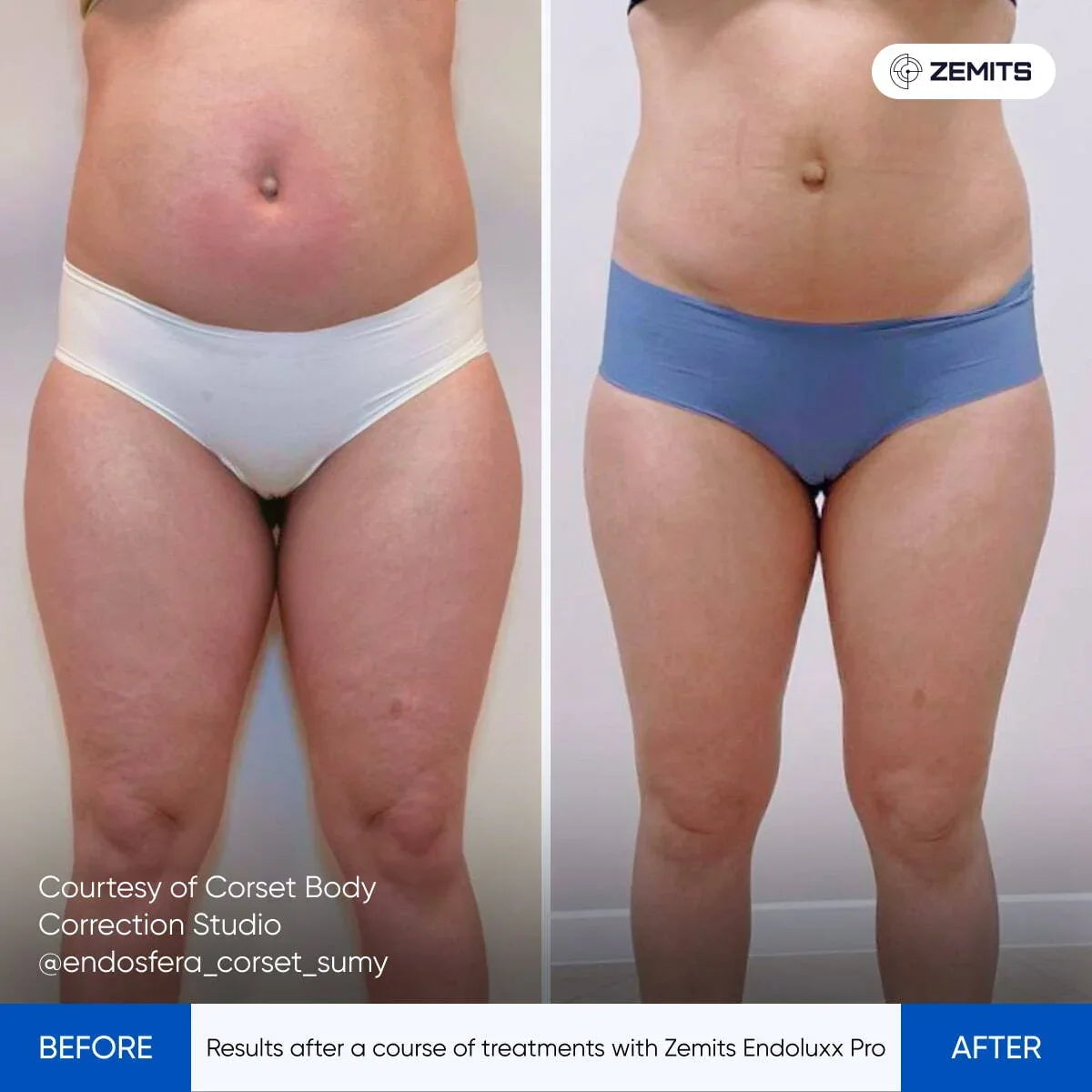 Before After Slide 1
