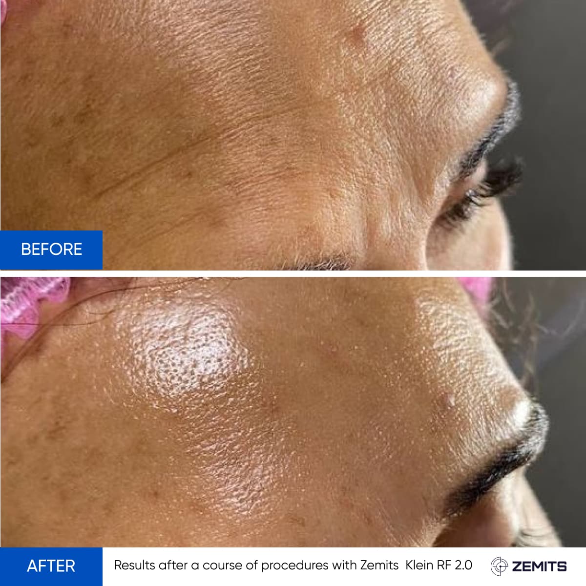Before After Slide 15