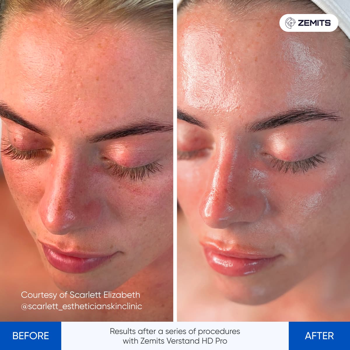 Before After Slide 1