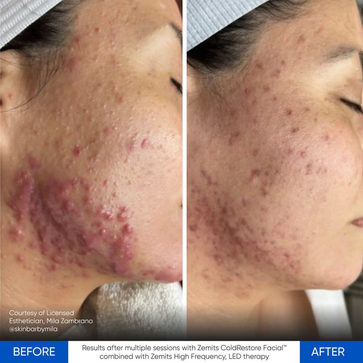 Before After Slide 2