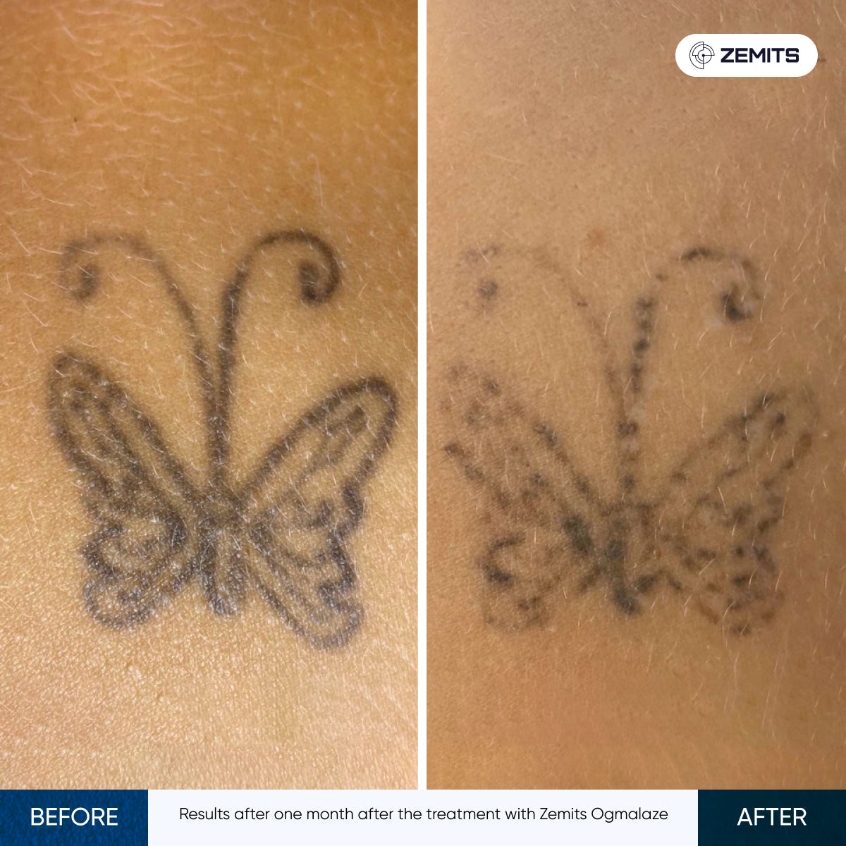 Before After Slide 4