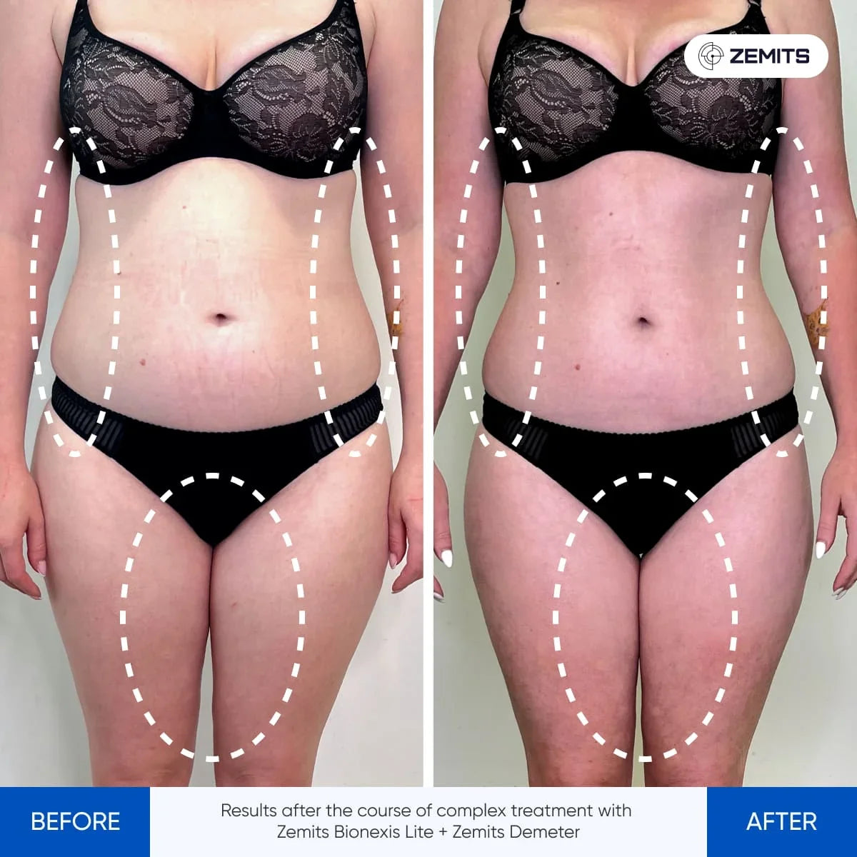Before After Slide 1
