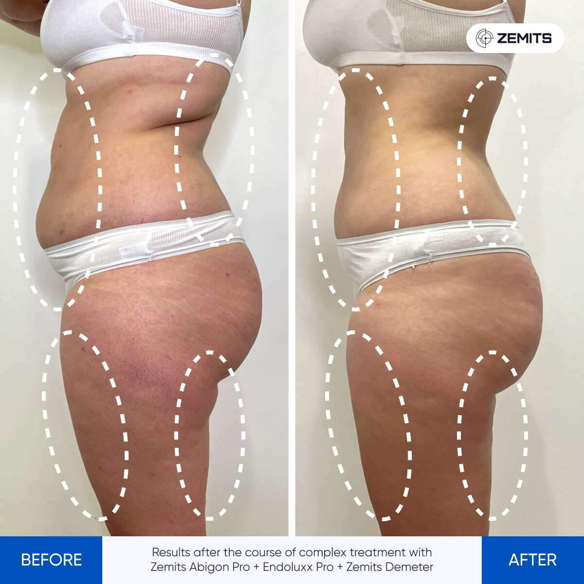 Before After Slide 2