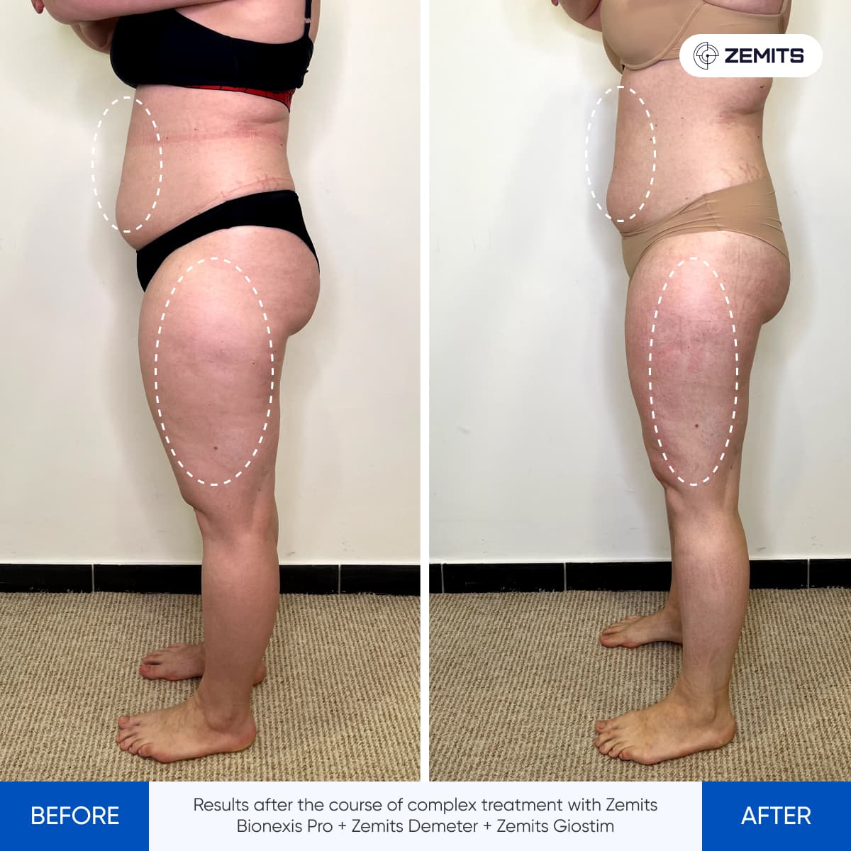 Before After Slide 2