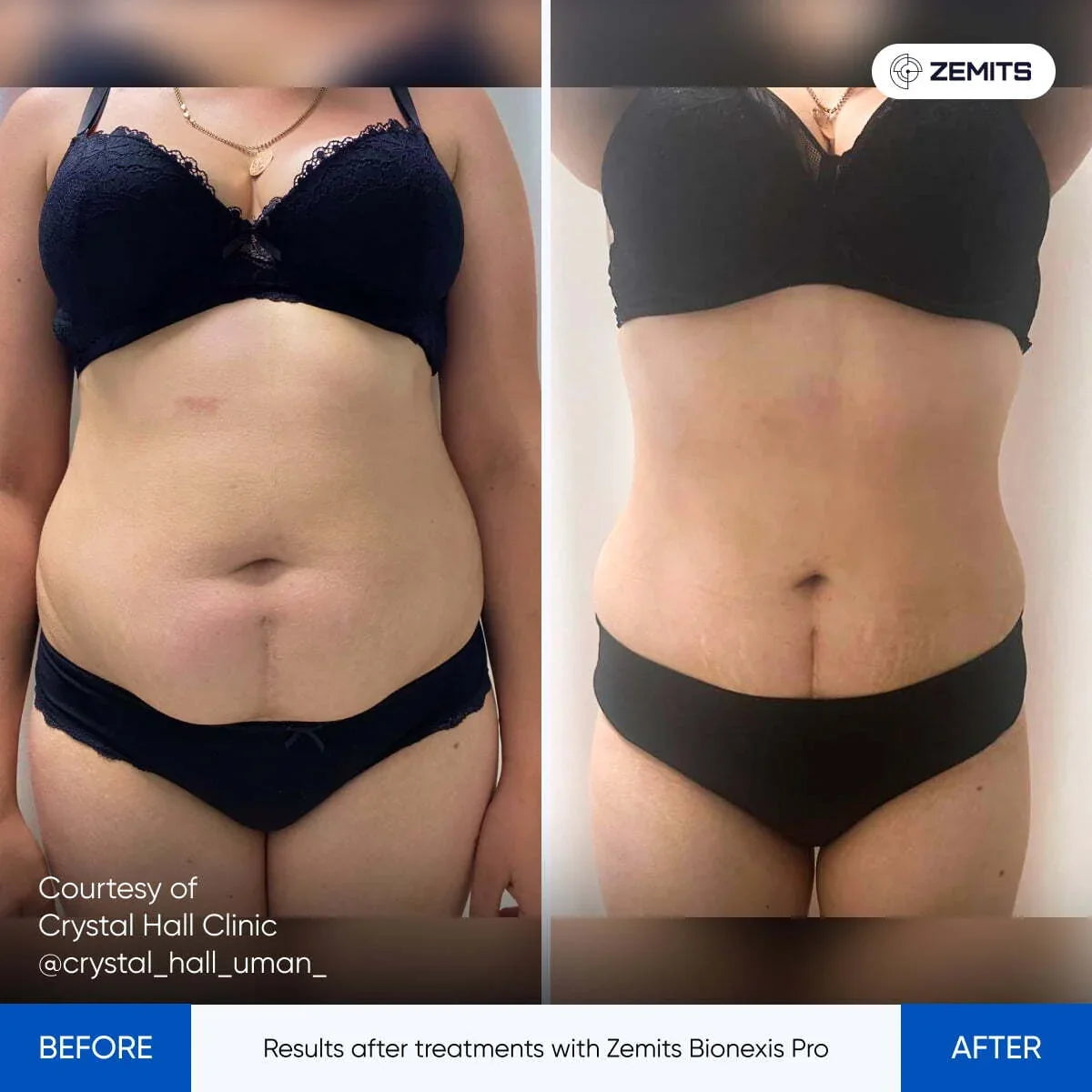 Before After Slide 1