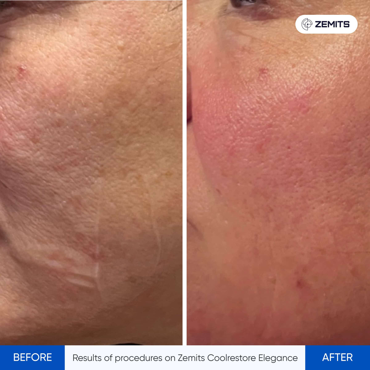 Before After Slide 2