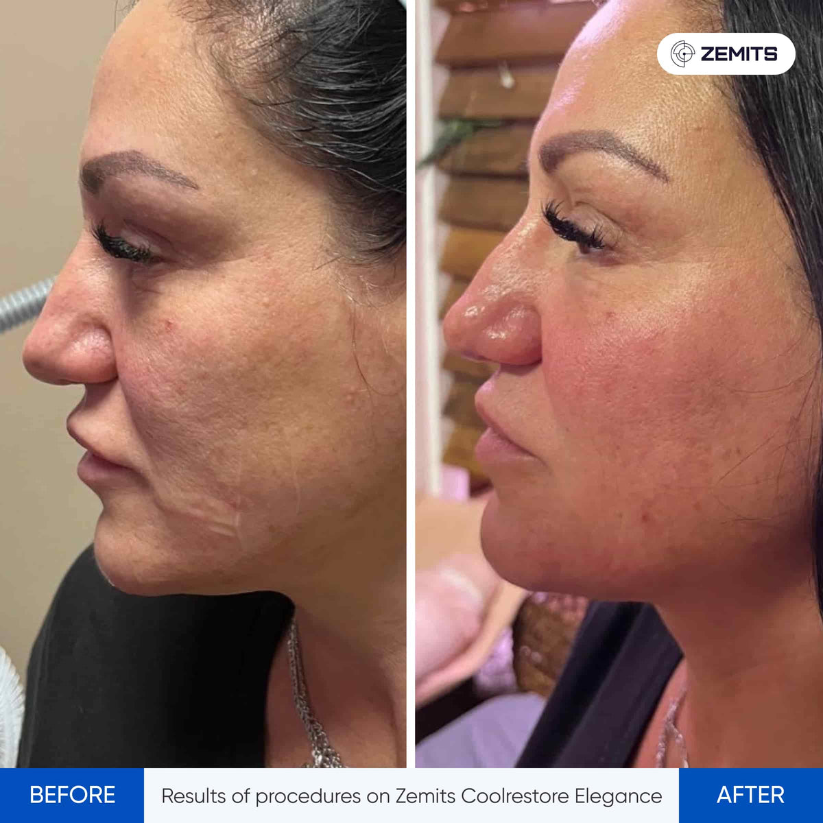 Before After Slide 3