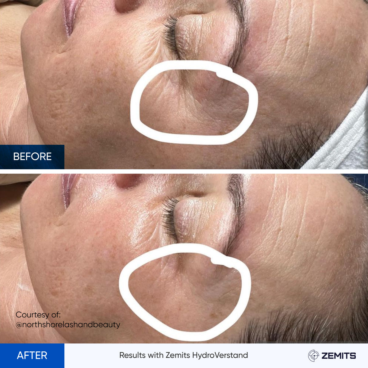 Before After Slide 5