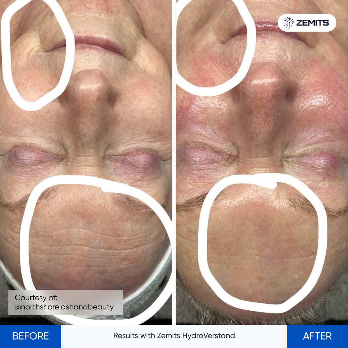 Before After Slide 6