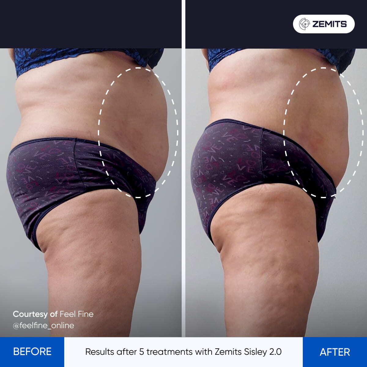 Before After Slide 1