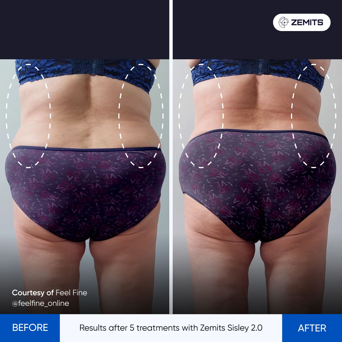Before After Slide 2