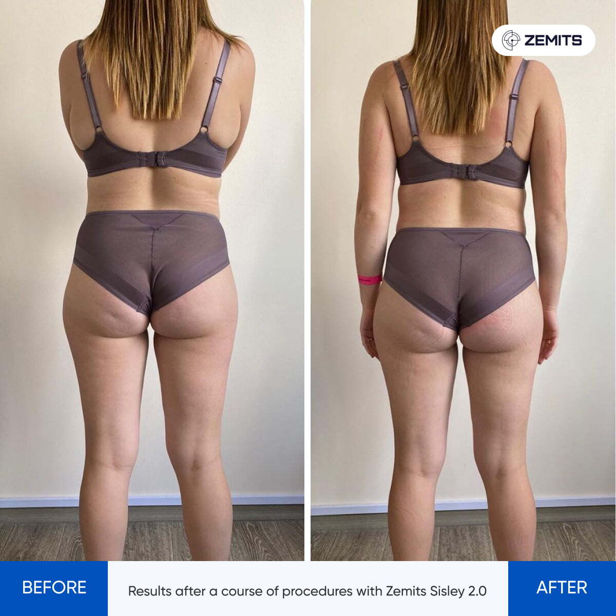 Before After Slide 5