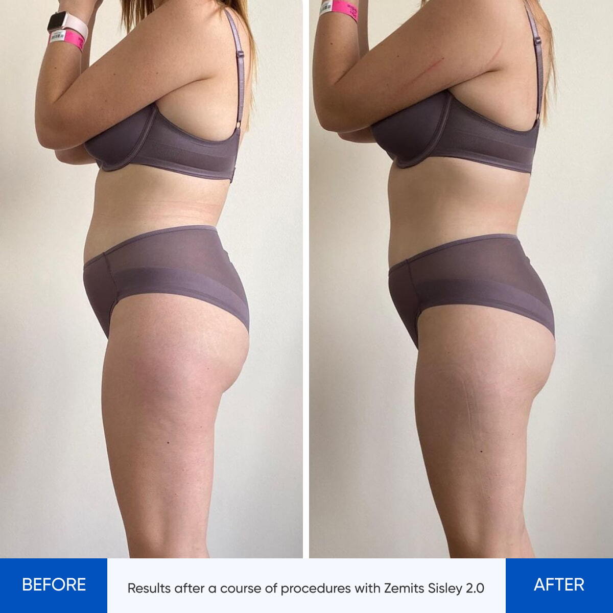 Before After Slide 6