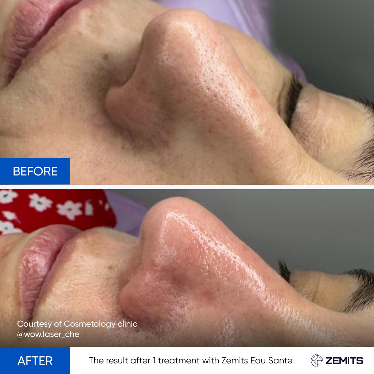 Before After Slide 3