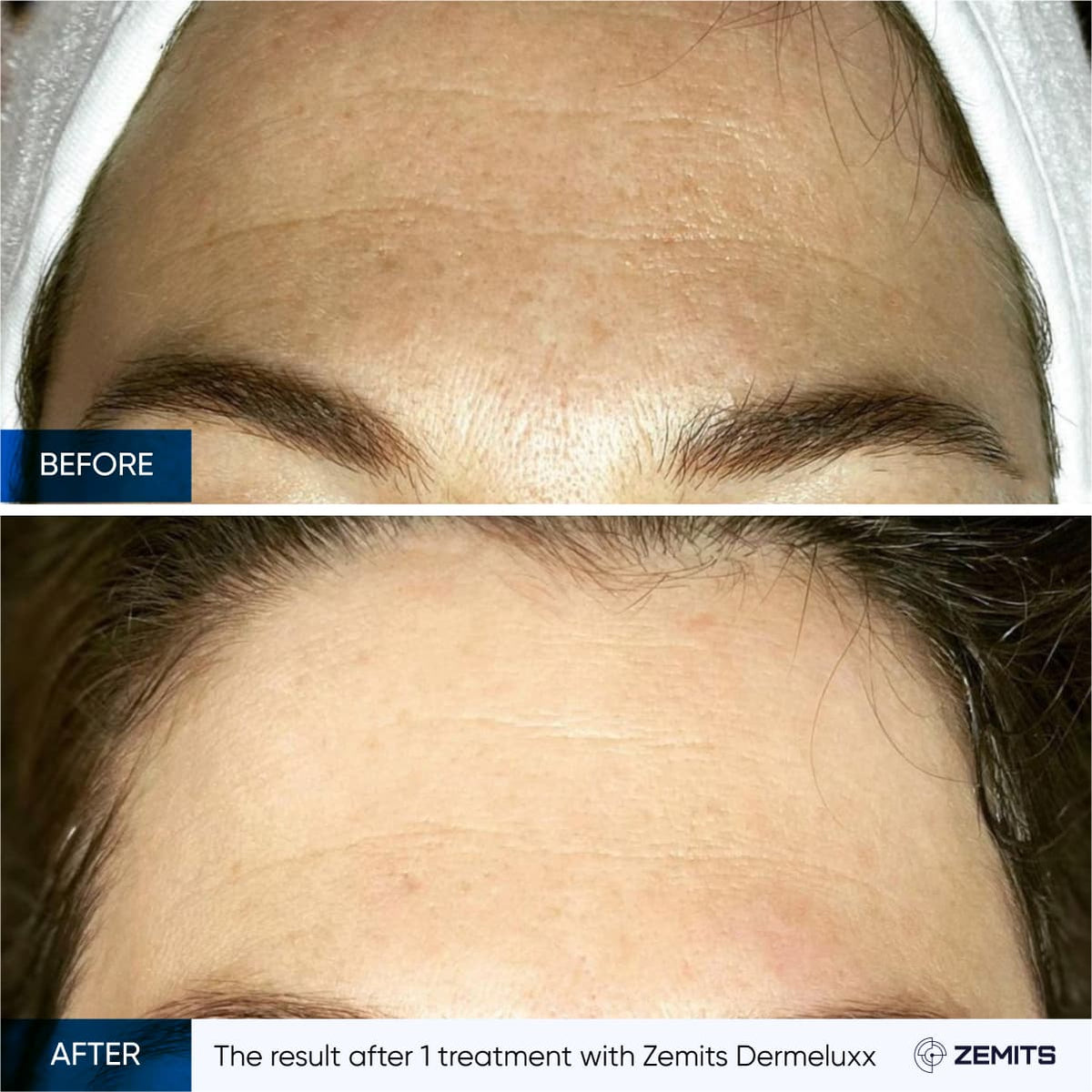 Before After Slide 5