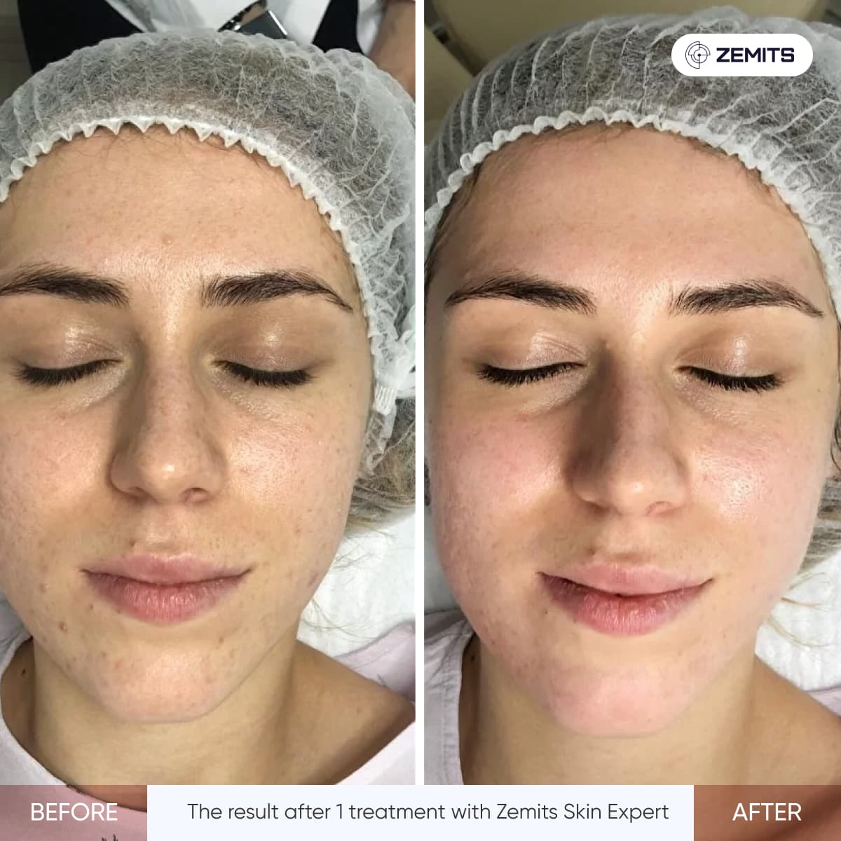 Before After Slide 1