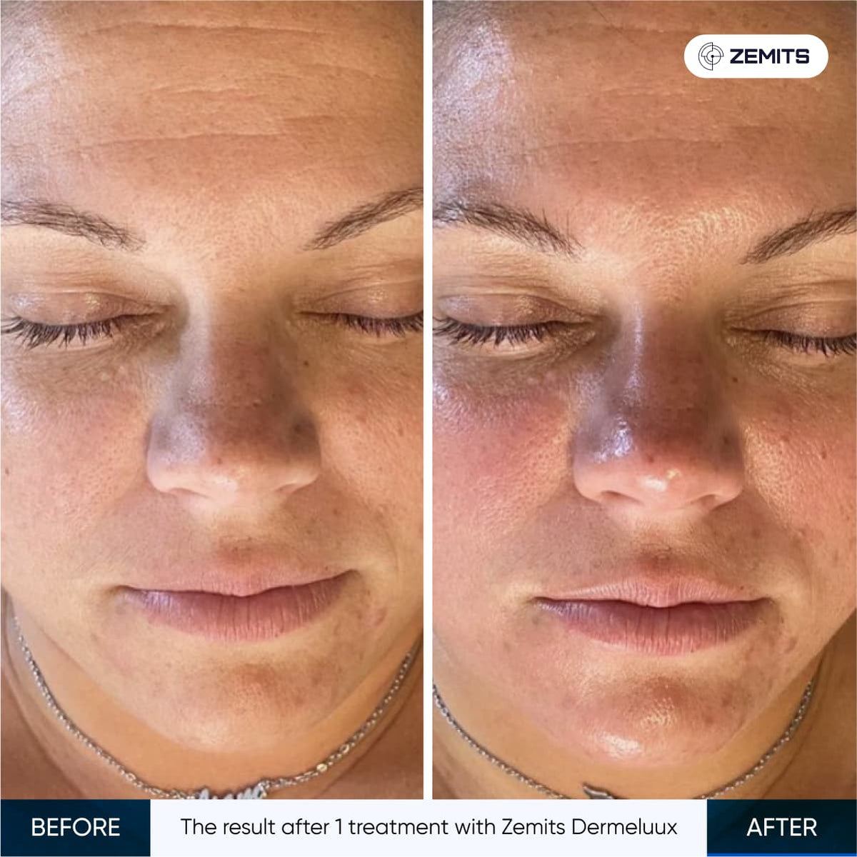 Before After Slide 7