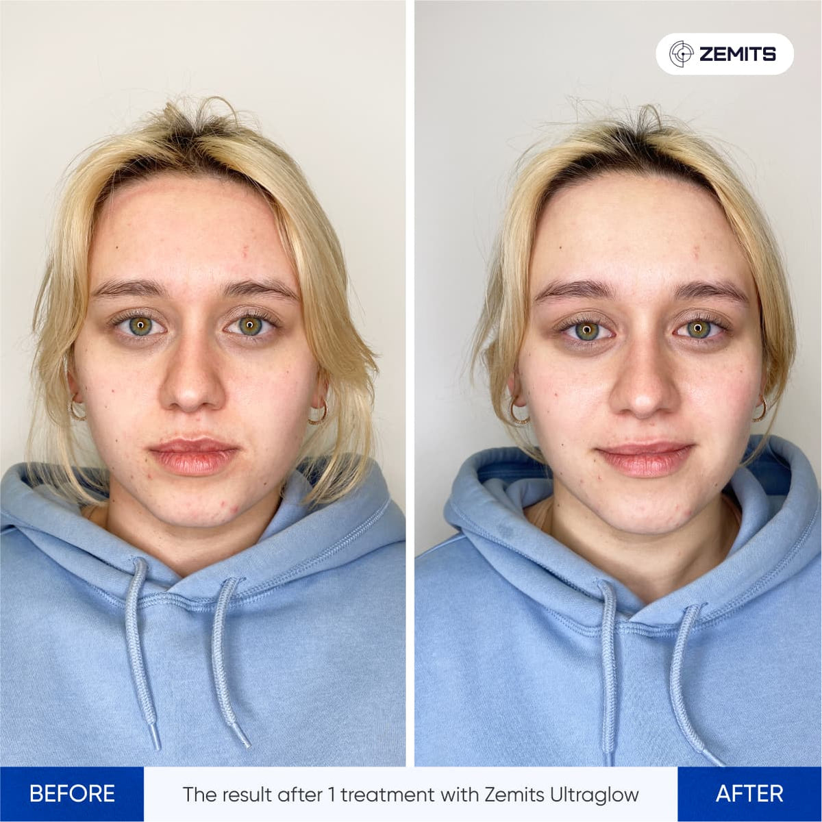 Before After Slide 1