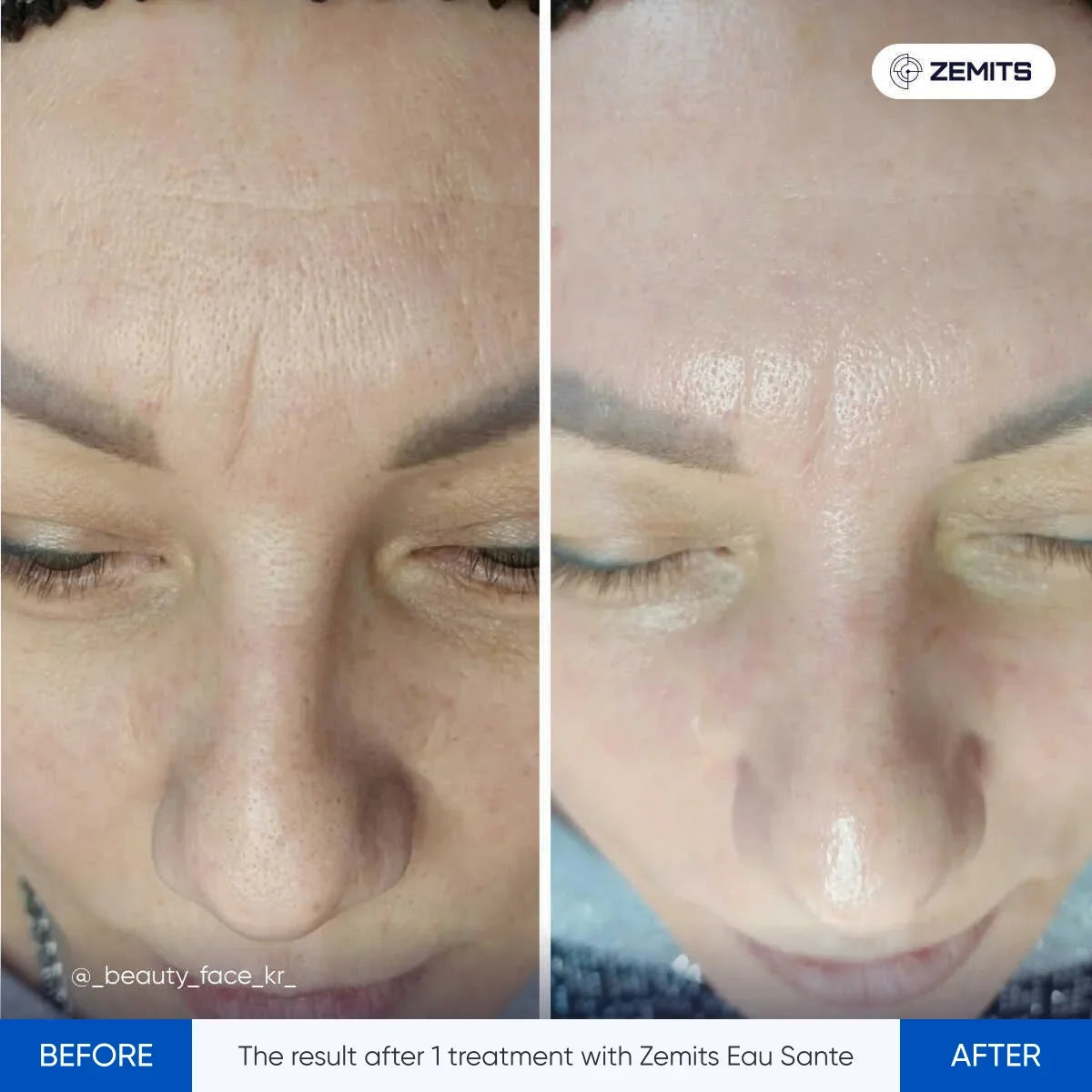Before After Slide 1