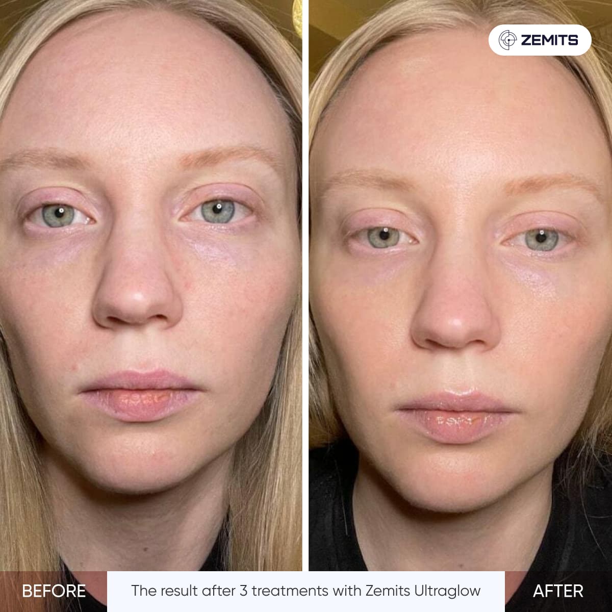 Before After Slide 2