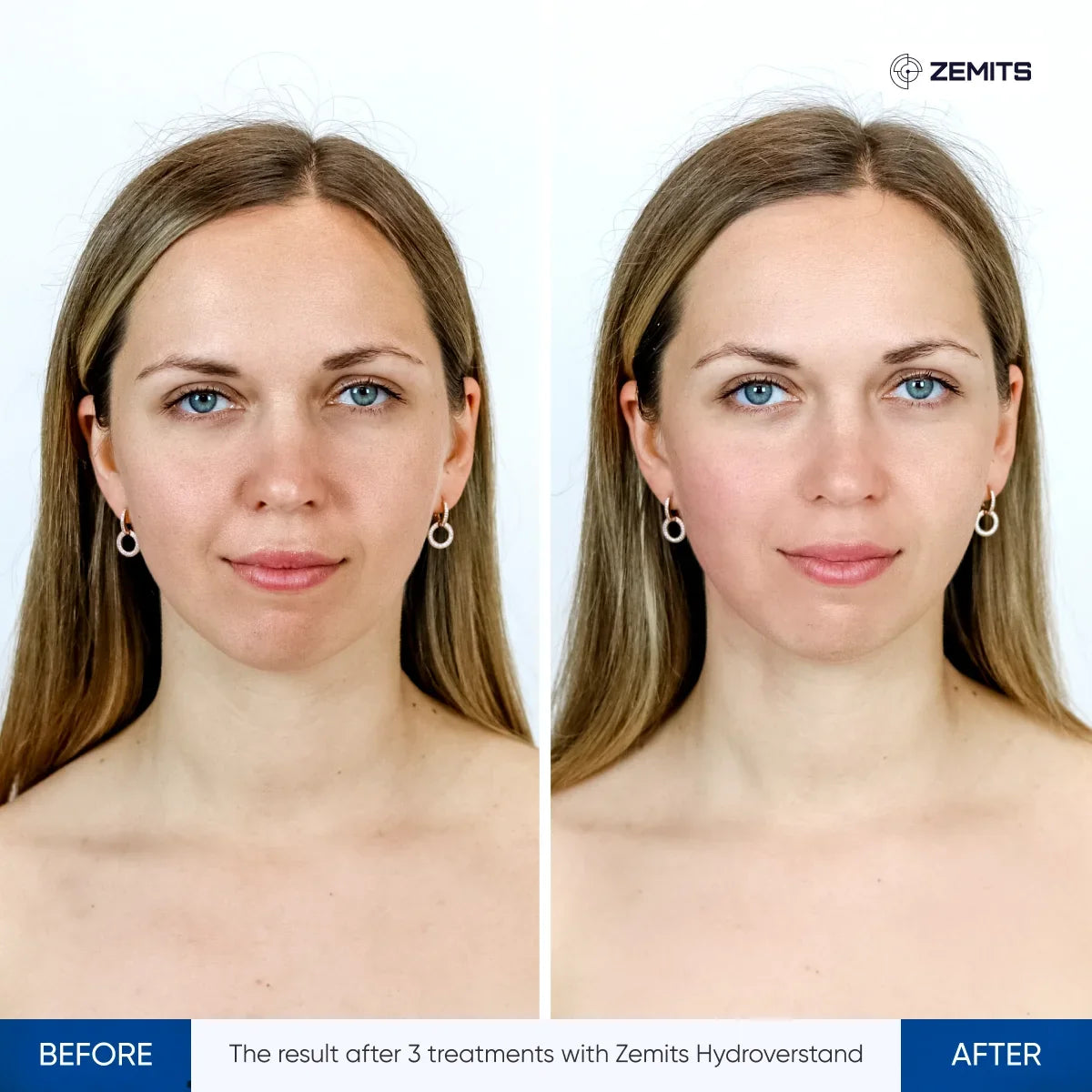 Before After Slide 2