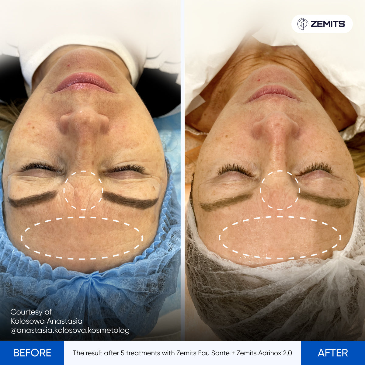 Before After Slide 4