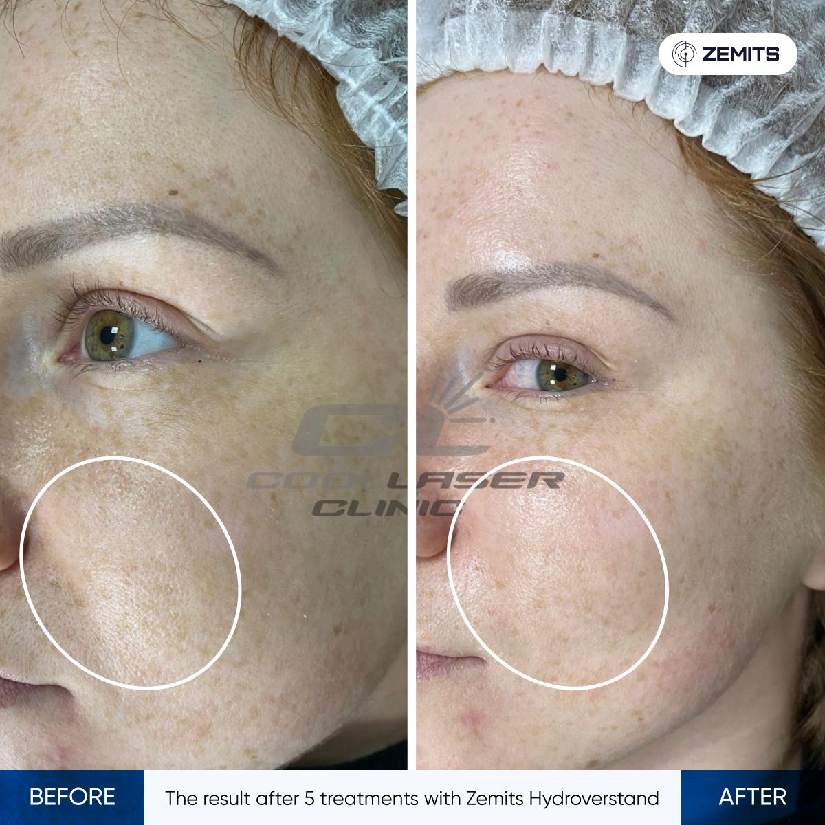 Before After Slide 9