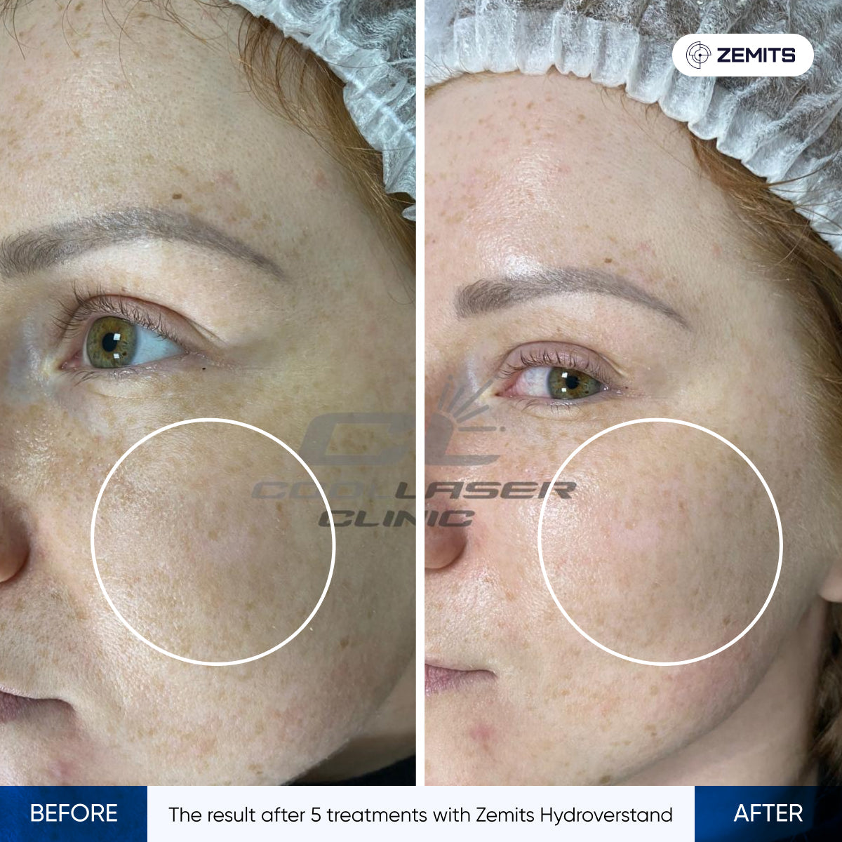 Before After Slide 1