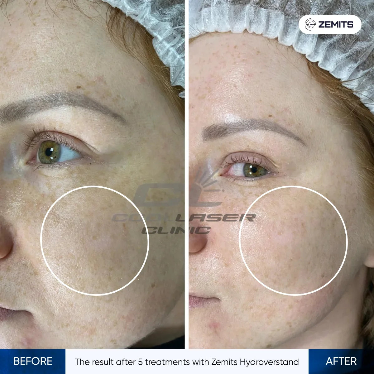 Before After Slide 1