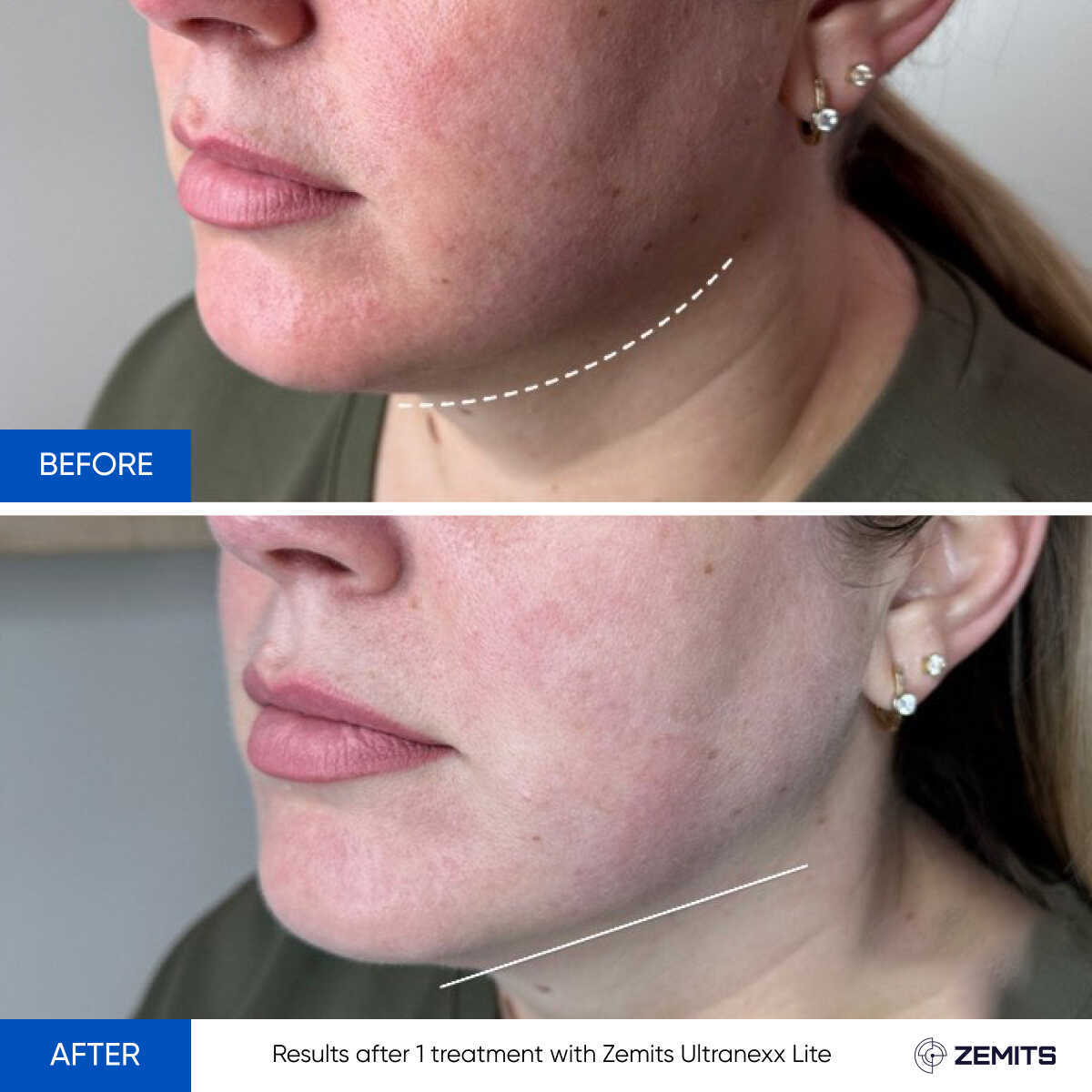 Before After Slide 8