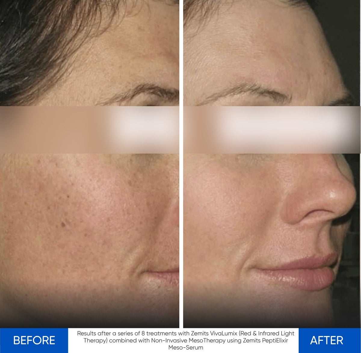 Before After Slide 4