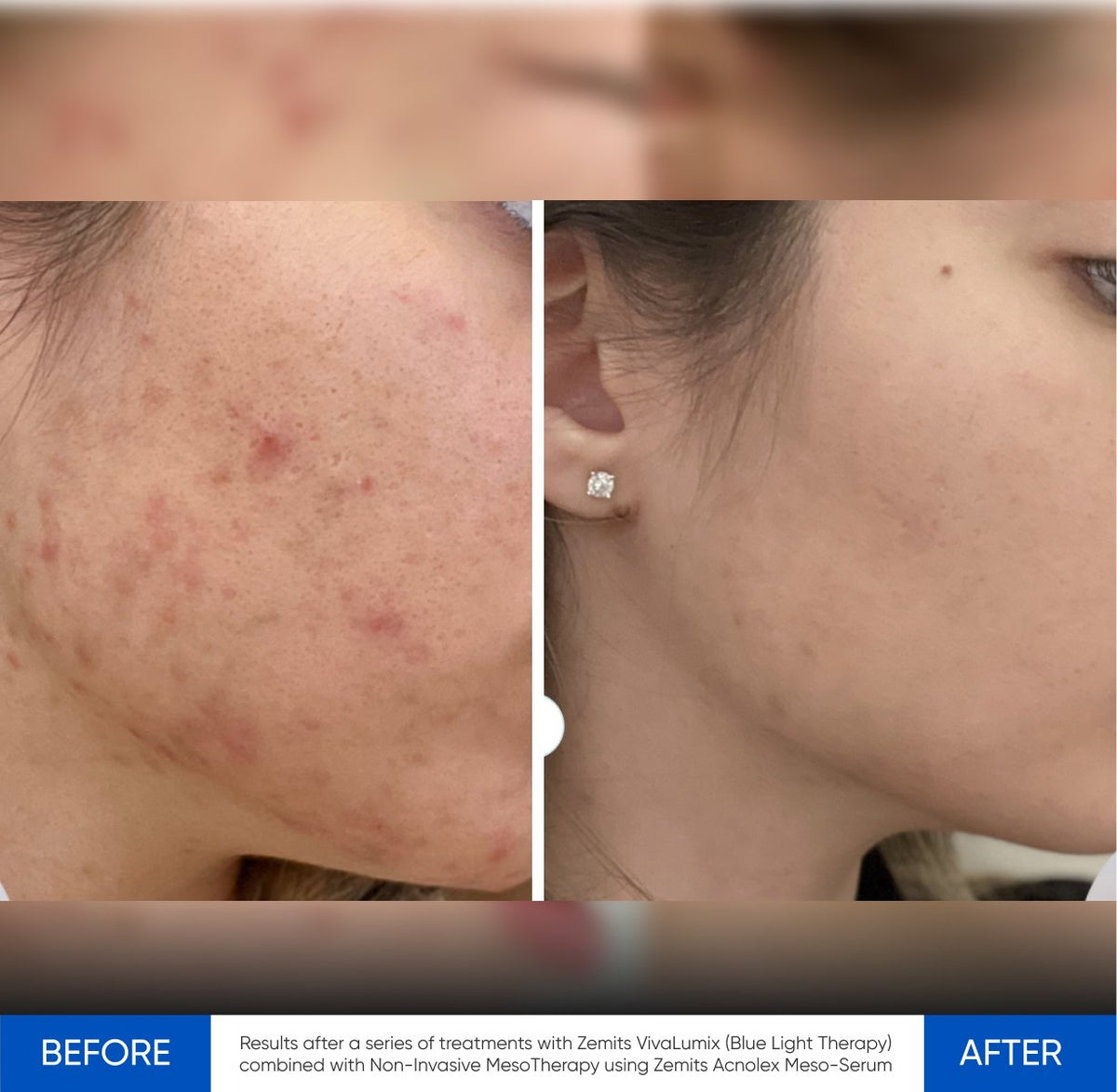 Before After Slide 5