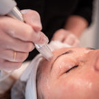 XCellarisPRO Twist forehead treatment close-up