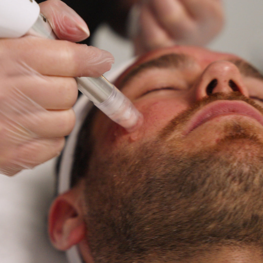XCellarisPRO Twist treatment on male client