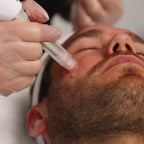 XCellarisPRO Twist treatment on male client