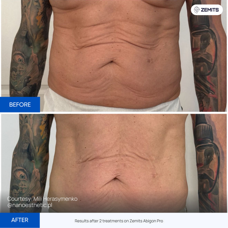 Before After Slide 2